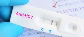 MS: Testarea gratuită pentru hepatite, esențială pentru prevenirea complicațiilor și transmiterii