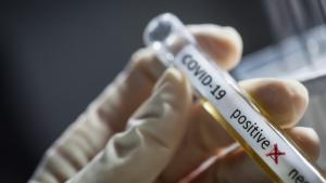 Doi angajați din Centrala MAE au fost confirmați cu noul coronavirus