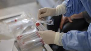 Terasă din Vama Veche închisă, după ce o angajată de la bar a fost infectată cu COVID-19